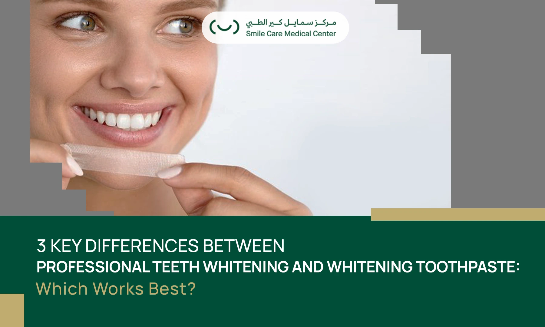 Learn the main differences between Professional Teeth Whitening and whitening toothpaste to understand which option works best for brighter results.
