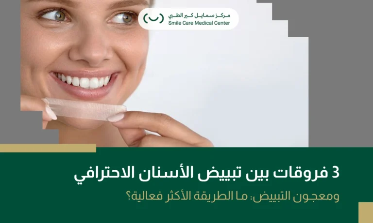 اكتشف أبرز الفروقات بين تبييض الأسنان الاحترافي ومعجون التبييض لمعرفة الخيار الأفضل للحصول على ابتسامة أكثر إشراقًا. اكتبهم عربي كاملين