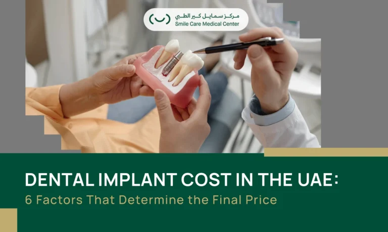 UAE Dental Implant Cost factors explained by a Smile Care Medical Center dentist.