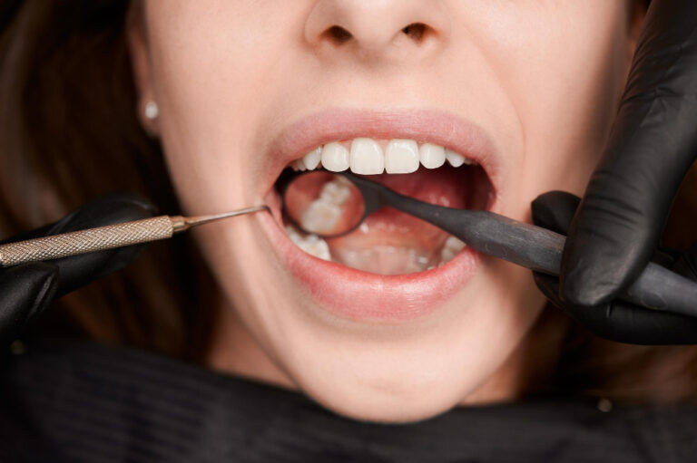 Gum Disease Treatment